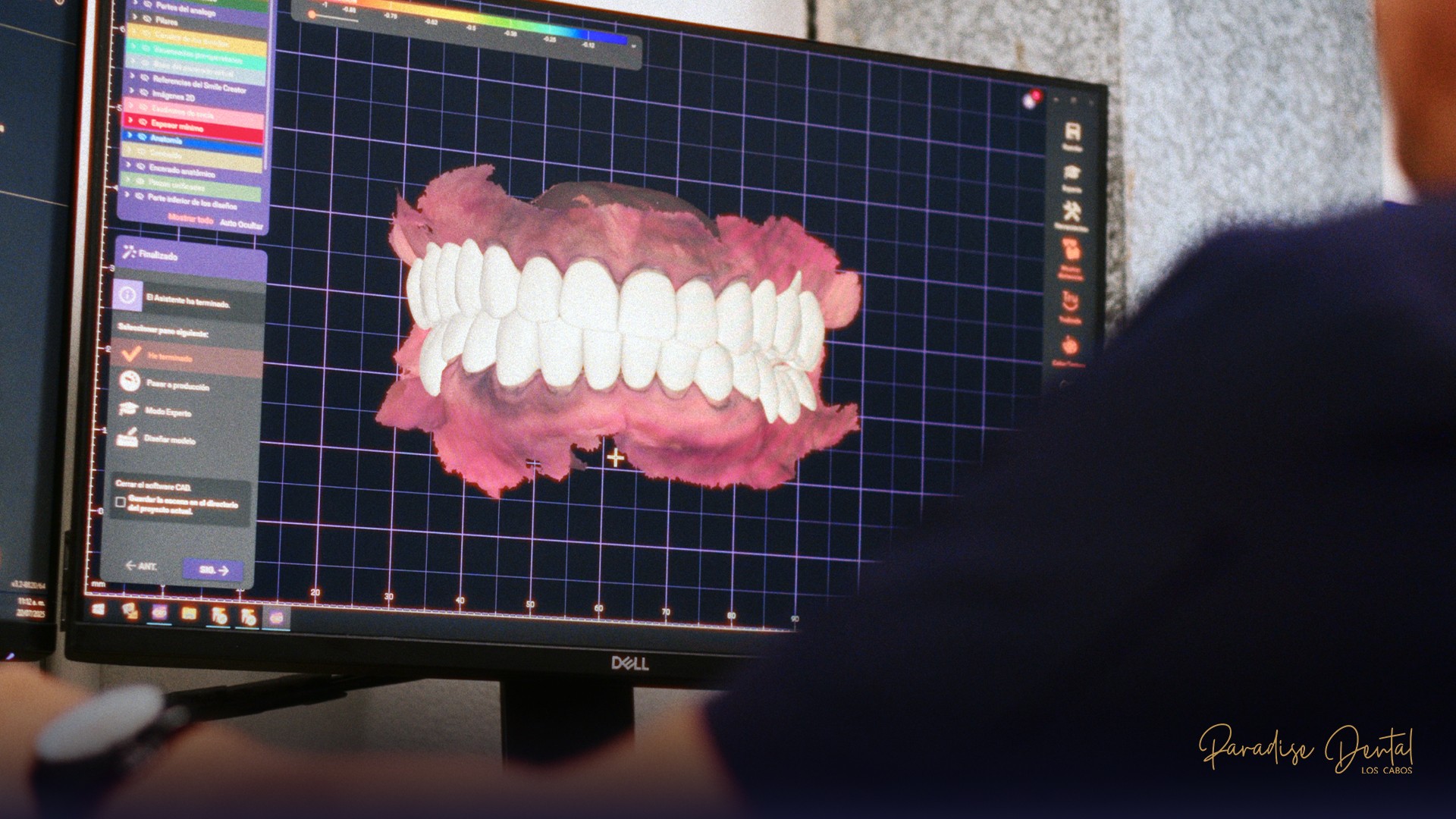 software-diseño-dental