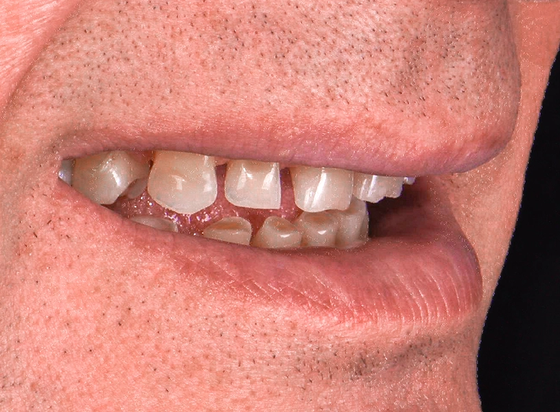 sonrisa-natural-amarilla-enferma