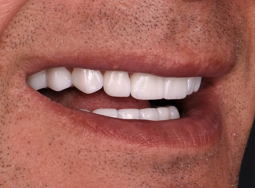 sonrisa-natural-amarilla-enferma