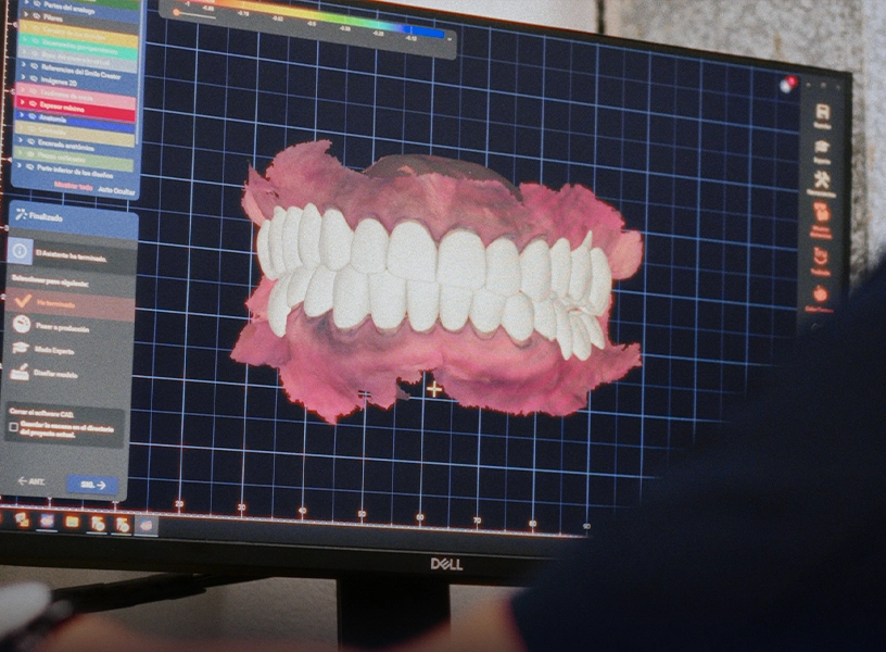 sonrisa-natural-amarilla-enferma